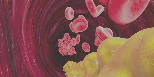 Animationsbild von Blutzellen und Fettablagerungen in einem Blutgefäß